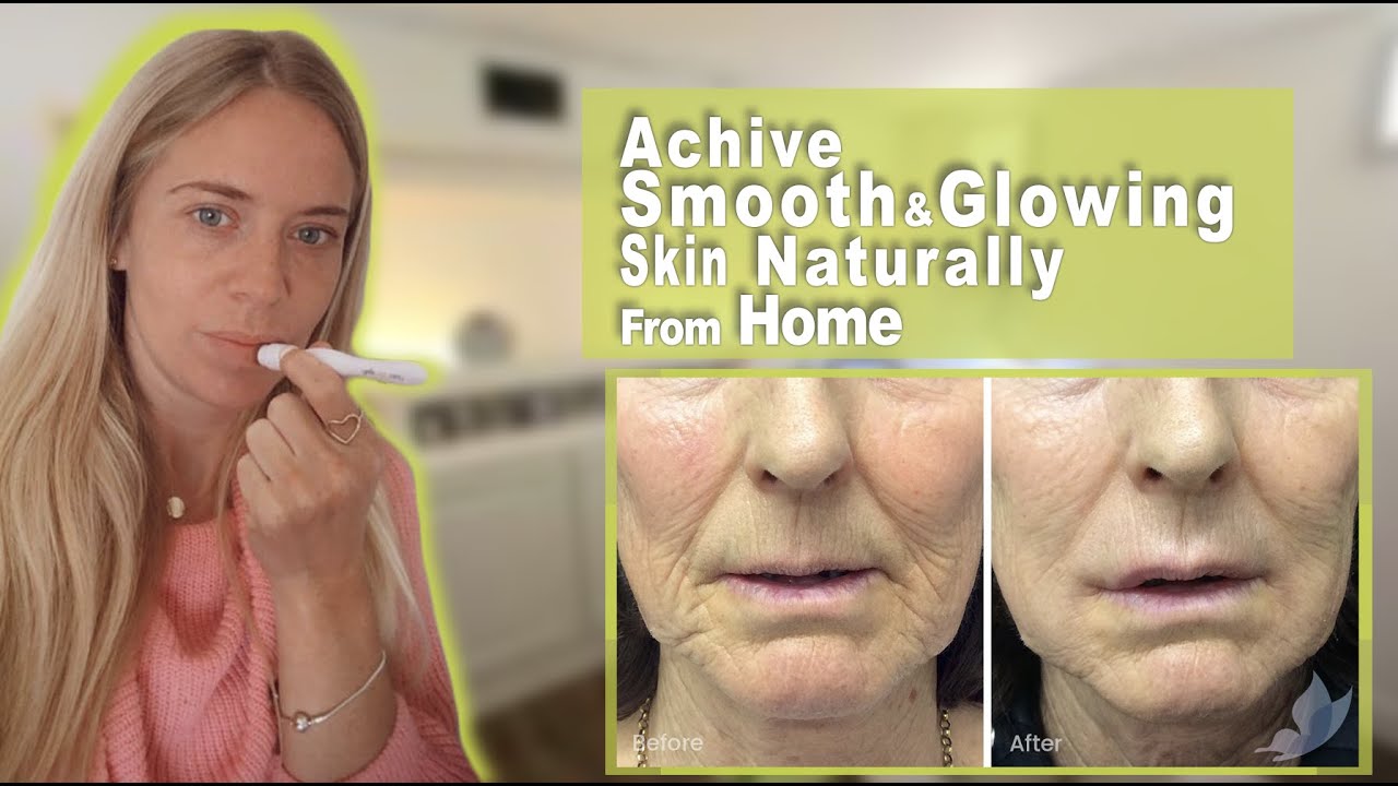 How To Reduce Fine Lines On Face Home Derma Rolling Micro Needling YouTube