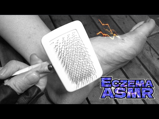 【猛烈に眠くなるアトピー性皮膚炎ASMR】超痒い足の側面を犬用毛玉取りで掻く音/癒し/リラックス効果/睡眠導入/マッサージ【モノクロ版】