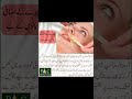 gair zrori balo Ka khatma غیر ضروری بالوں کا خاتمہ