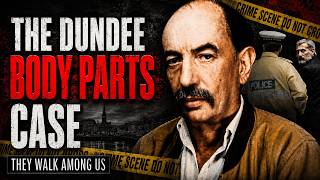 Dundee Headless Torso: A True Crime Case