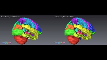 Surface Rendering Selected Brain Rotation 3D