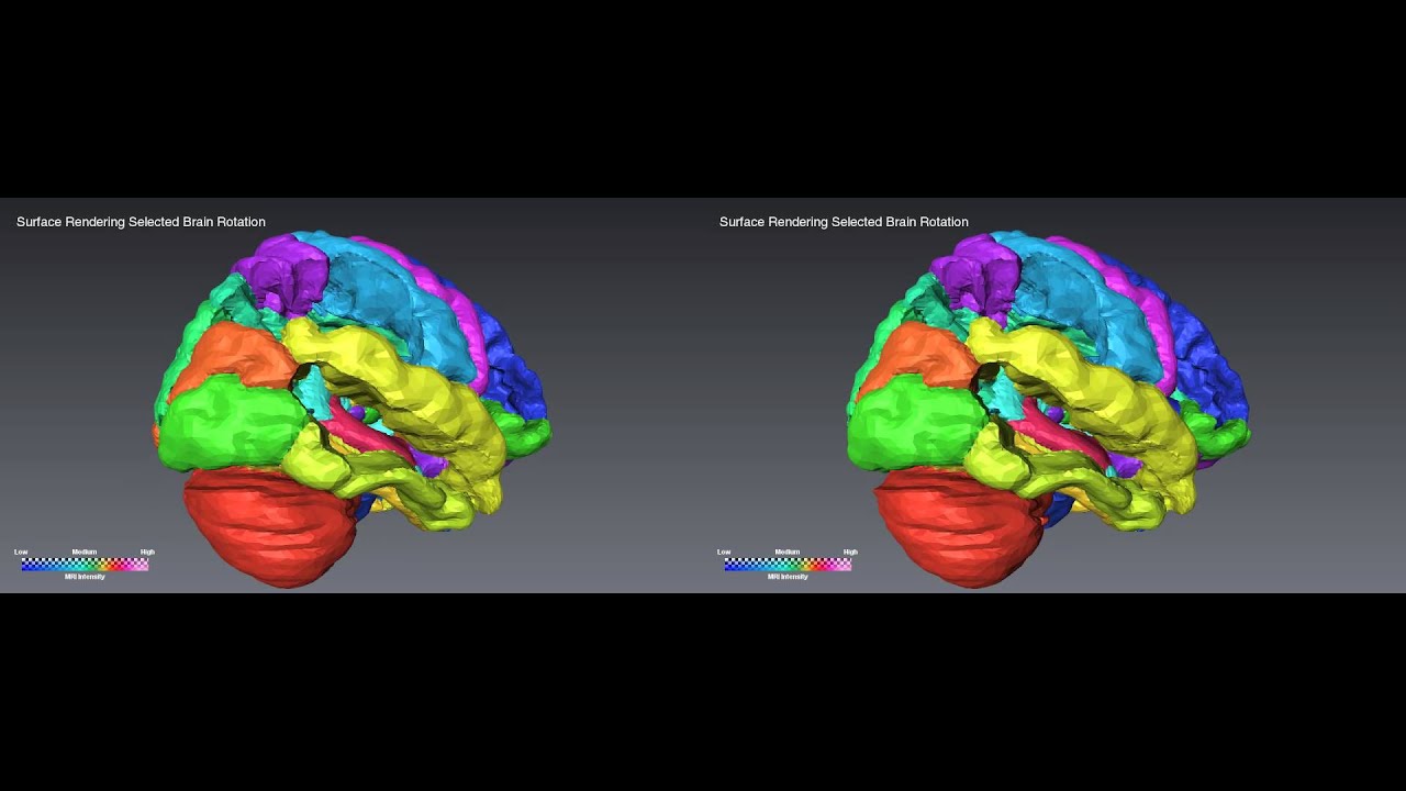 Surface Rendering Selected Brain Rotation 3D - YouTube