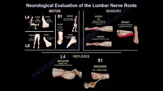 Neurological Evaluation Of The Lumbar Nerve Roots, how do you diagnose the affected nerve?