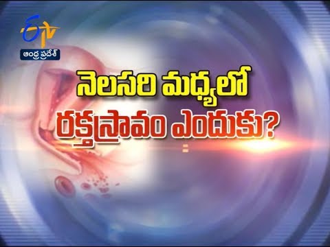 నెల మధ్యలో రక్తస్రావం ఎందుకు? | సుఖీభవ | 27 జూన్ 2017 | ఈటీవీ ఆంధ్ర ప్రదేశ్