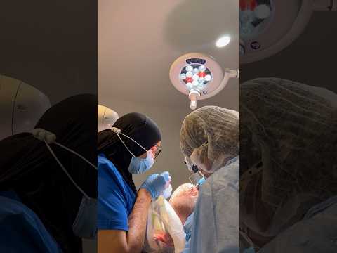 Hair Surgeons Uncovers The Ultimate Hair Restoration Journey #haircare #hairloss #hairgrowth