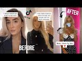 TikTok lip filler check part 2!!