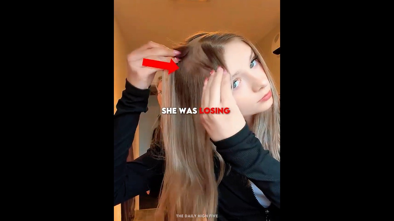り*ん様 【美品】THE HAIR / Out Of Our Hair She Was Losing All Her Hair… 🥺 - YouTube