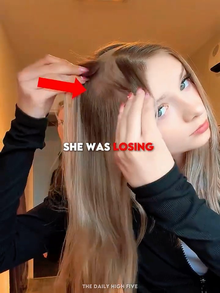 She Was Losing All Her Hair… 🥺 - YouTube