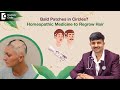Homeopathy Medicine for Hair Fall and Regrowth | Onion Juice For Hair Growth? - Dr. Sanjay Panicker