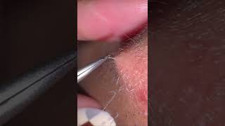 ASMR Beardcare plucking beard #beardcare #tweezer #skincare #asmrbeard