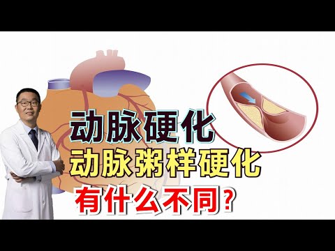 动脉硬化和动脉粥样硬化，一样吗？两者之间有什么区别？医生讲解