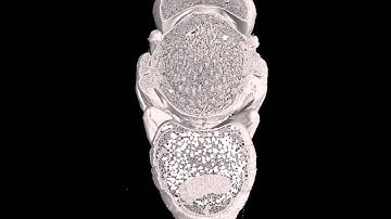 4. Digital dissection of an insect using rendered MicroCT data