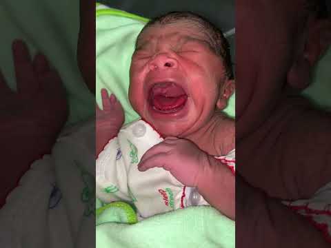 Baby Now Cry Bcg Vaccination Inert Now Docter After Birth Cute Baby Newbornbaby Baby Cute