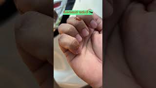 ಕೆಂಪು ಸುಂದರಿ… 🐜 #insects #karnataka #coffeelover #india #shorts #ants # #motivation #ವೈರಲ್ #funny