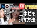 【新機能】Camera Rawバージョン18.5「傷を削除」でニキビを消す方法【Photoshop講座】