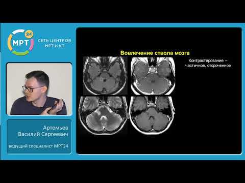 Video: Differenza Tra ESR NMR E MRI