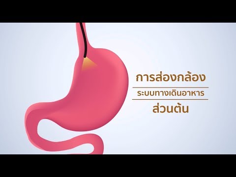 การส่องกล้องระบบทางเดินอาหารส่วนต้น (upper GI endoscopy) | บำรุงราษฎร์