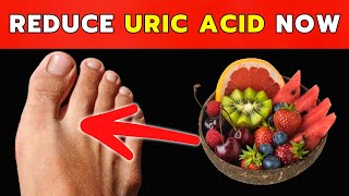 Top 8 Foods That Reduce Uric Acid Levels Naturally