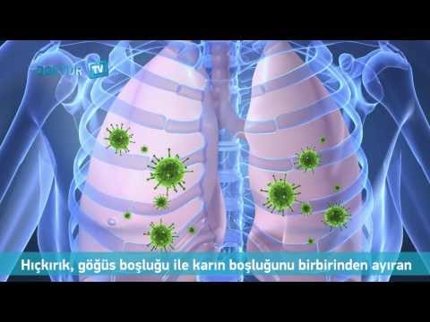 Hıçkırık Nedir Nasıl Geçer