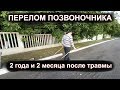 Перелом позвоночника. 2 года и 2 месяца после травмы