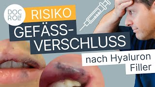 So erkennst du einen GEFÄSSVERSCHLUSS nach HYALURON! Dr. Rolf Bartsch