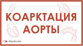 картинка: Коарктация аорты