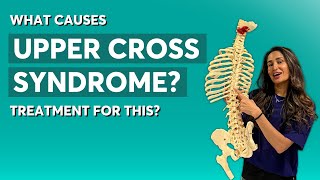 What Causes Upper Cross Syndrome & What Treatments are Available?