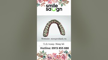 Phác đồ Niềng răng hô  - SmileSalign Việt Nam