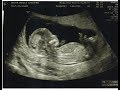 Im pregnant  gender reveal pregnancy announcement  angela lanter