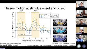 Amelia Strom: Cortical displacement driven by visual stimulation using DENSE EPI at 7T