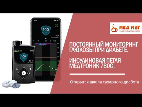 Постоянный мониторинг глюкозы при диабете. Инсулиновая петля Медтроник 780G