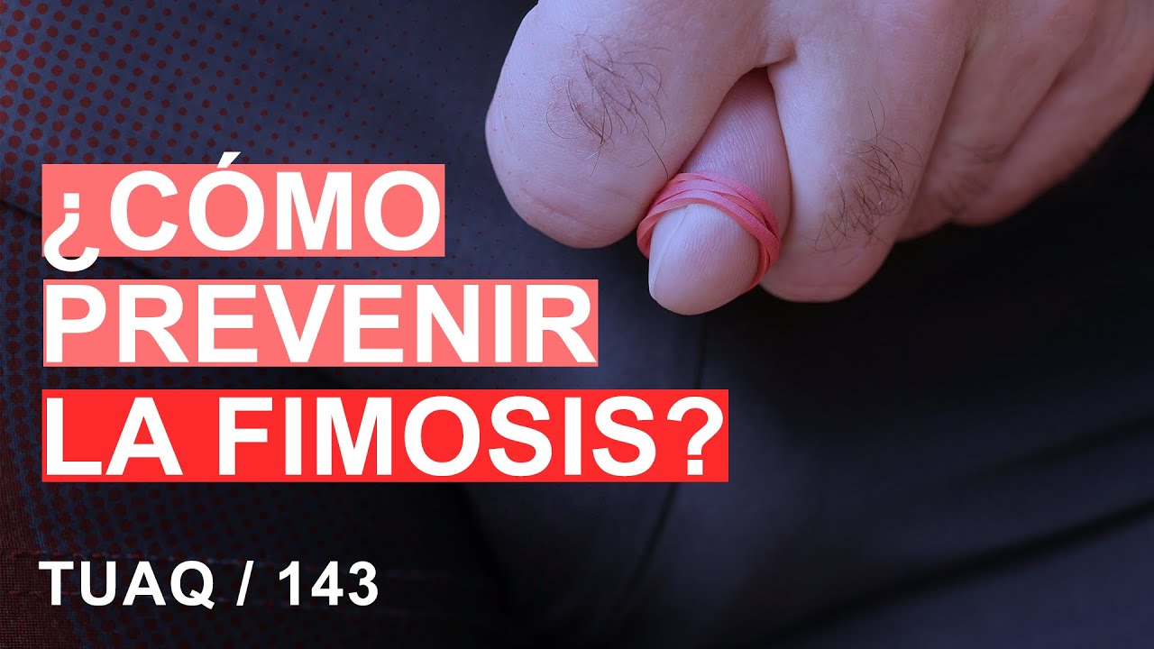 ¿Cómo prevenir la #fimosis ?