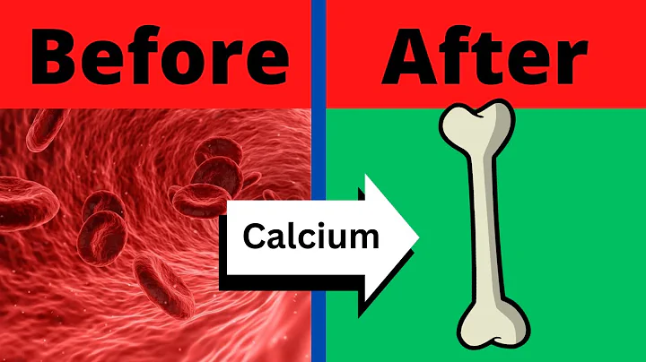Vitamin K2 takes Calcium out of your Arteries and into your Bones
