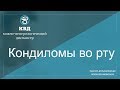 377 Кондиломы во рту