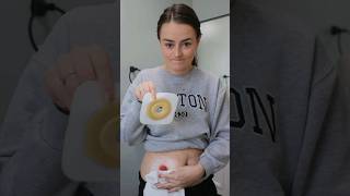 Realistic Ostomy Change - When Your Stoma is a Volcano | #ostomy | Let&#39;s Talk IBD