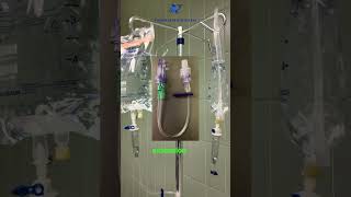 Don’t set your IV pump to 999 to administer a fluid bolus