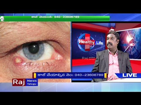 కంటి సంబంధిత సమస్యలకు డాక్టర్ సలహాలు | Doctor&rsquo;s Advises On Eye Infections Part-2 | Raj News Telugu