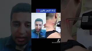 حكم إزالة الشعر بالليزر ?