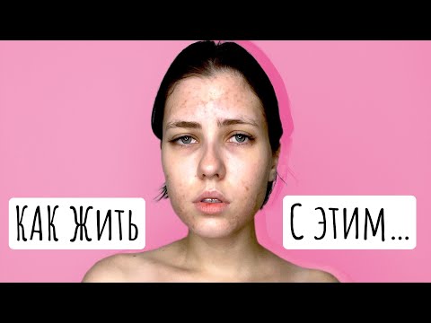 все думают, что я некрасивая...