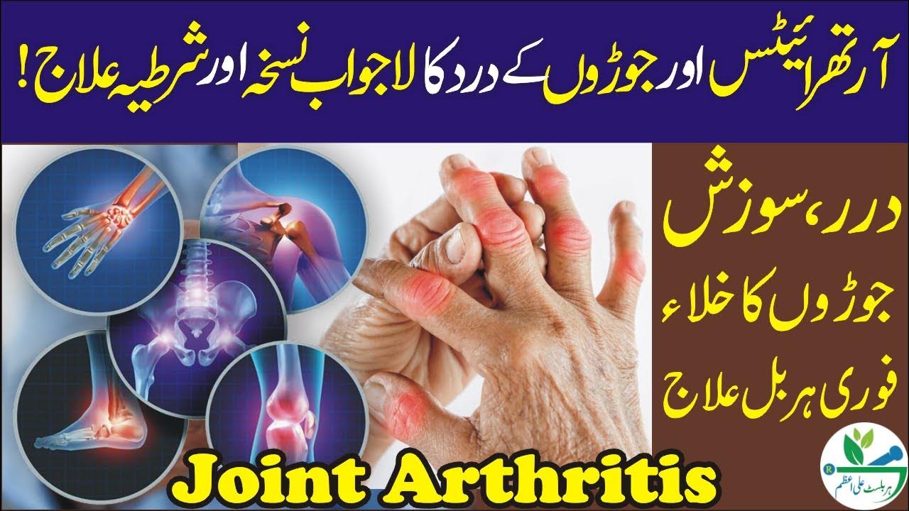 arthritis-pain-herbal-treatment-jordon-ky-dard-ka-herbal-ilaj-by