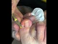 Gentle Toenail Trim | Relaxing Foot Care Routine #nails #footcare