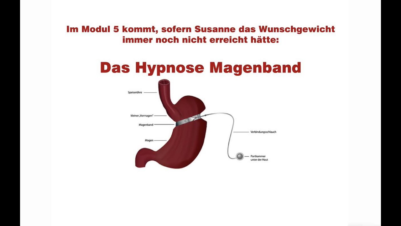 Magenbänder zum Abnehmen