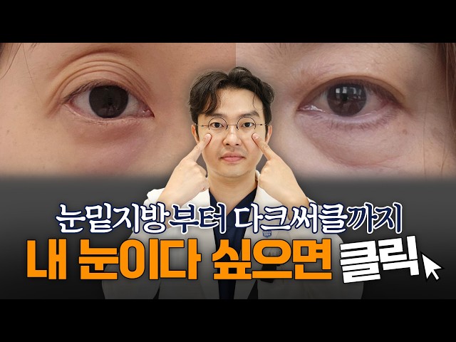 눈밑 때문에 유독 피곤해 보인다면 무조건 꼭 보세요!