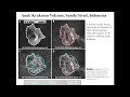 L15- Application of InSAR for Volcanic Eruption and Associated Deformation by Dr. Shashi Kumar