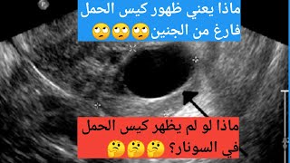 ماذا يعنى عدم ظهور كيس الحمل فى السونار بالرغم من اختبار الحمل الايجابى/كيس الحمل الفارغ