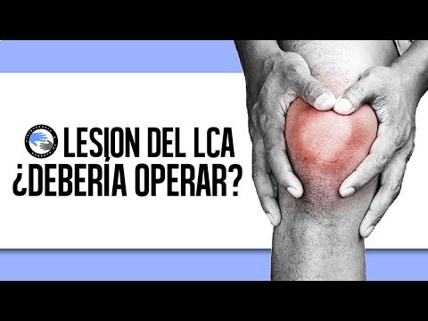 Vídeo: ¿Se Puede Caminar Sobre Una LCA Rota? Aprende Más