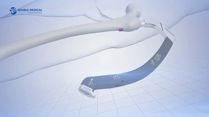 Double Medical APFN operation video