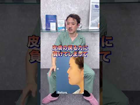 耳軟骨での鼻手術は100%戻る!?#shorts