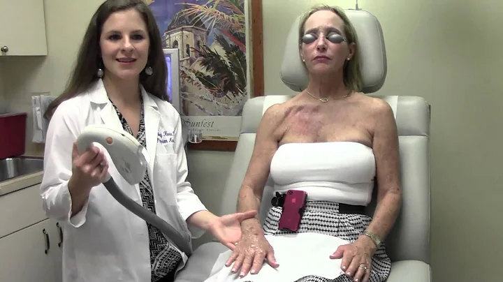 IPL Treatment Demonstration (Intense Pulse Light)