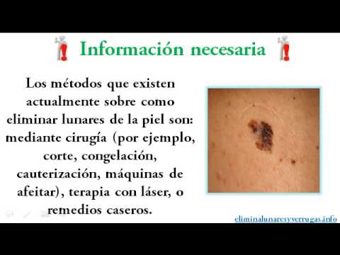 Como eliminar los lunares en la piel